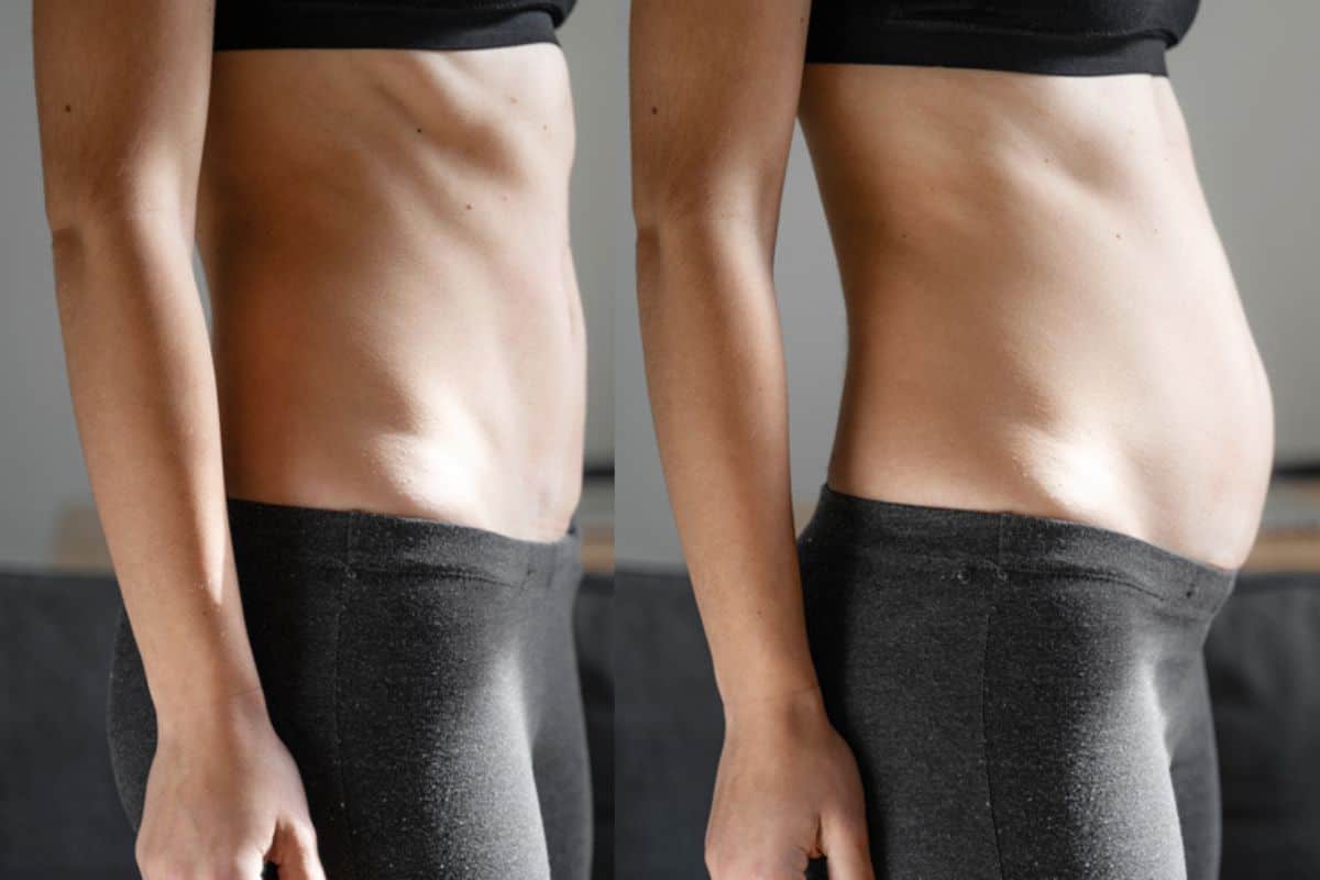 How long does diastasis recti take to improve Felixstowe?