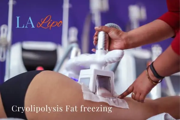 women getting fat freezing Felixstowe